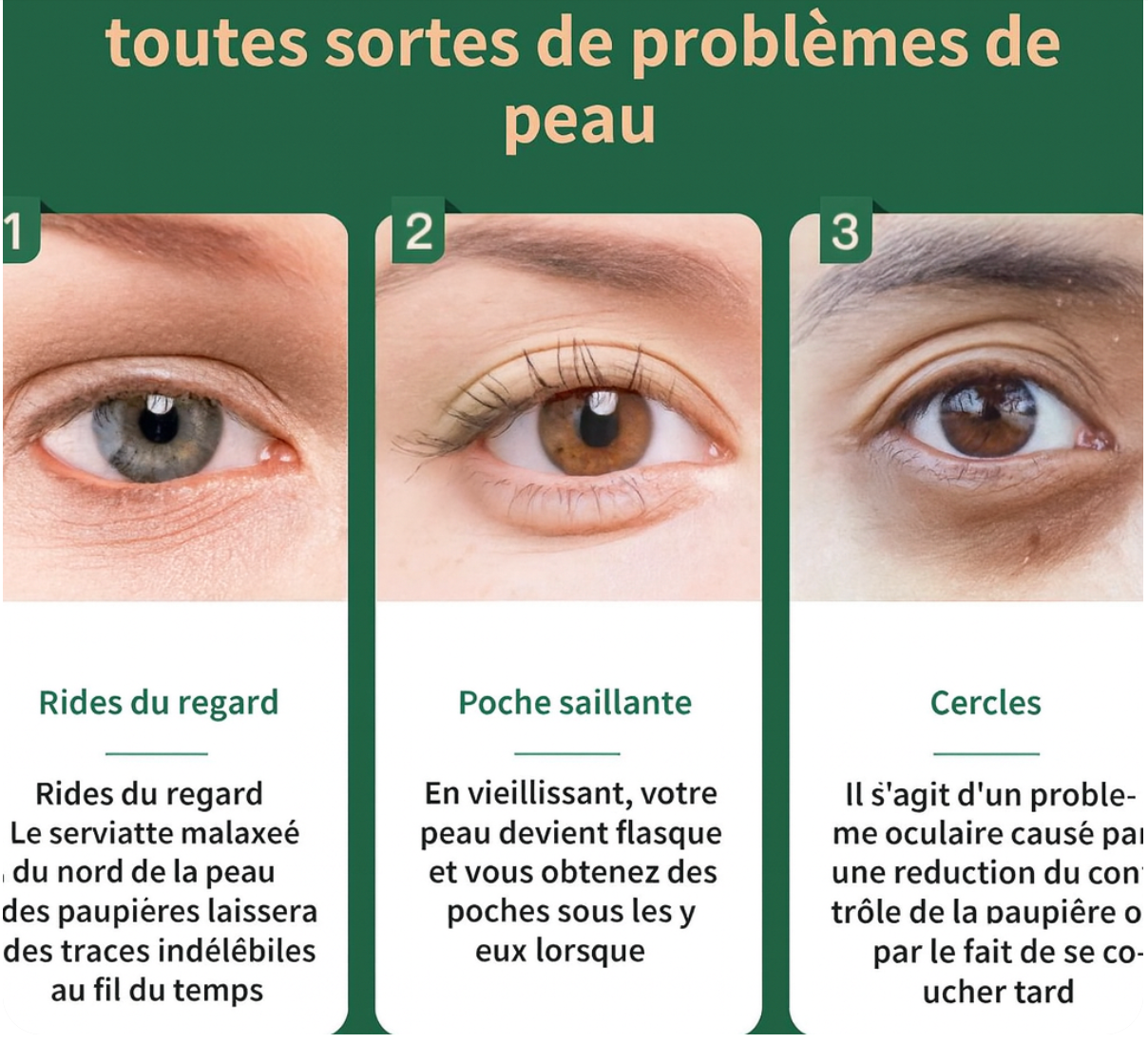 HIFU Anti-rides 4-en-1