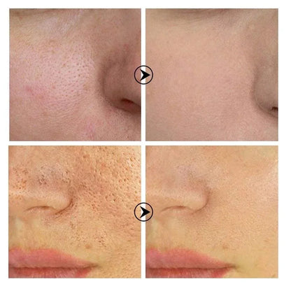 Sérum Éclat & Pores — Rétinol + Niacinamide (10 ml)