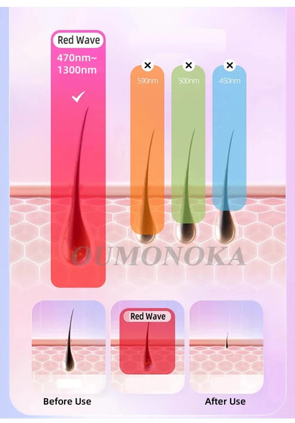 Épilateur laser IPL permanent,