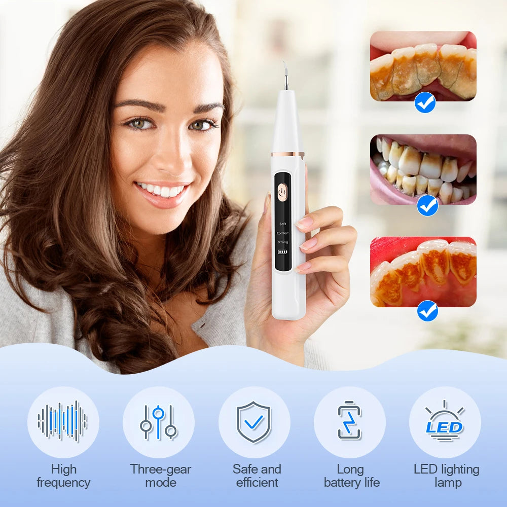 Irrigateur dentaire électrique – Nettoyage en profondeur & blanchiment