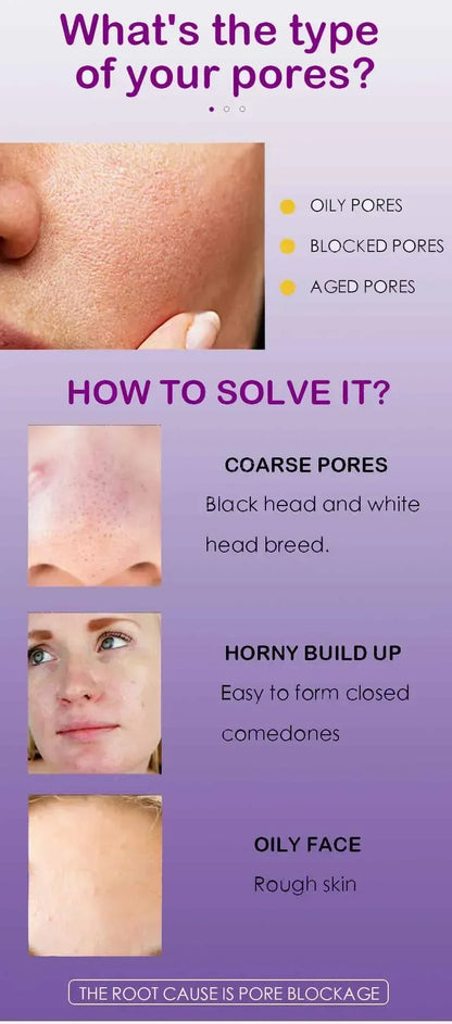 Sérum Éclat & Pores — Rétinol + Niacinamide (10 ml)