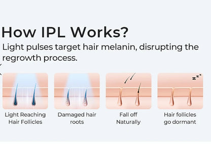 Épilateur laser IPL permanent,