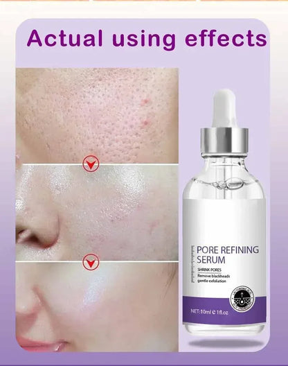 Sérum Éclat & Pores — Rétinol + Niacinamide (10 ml)