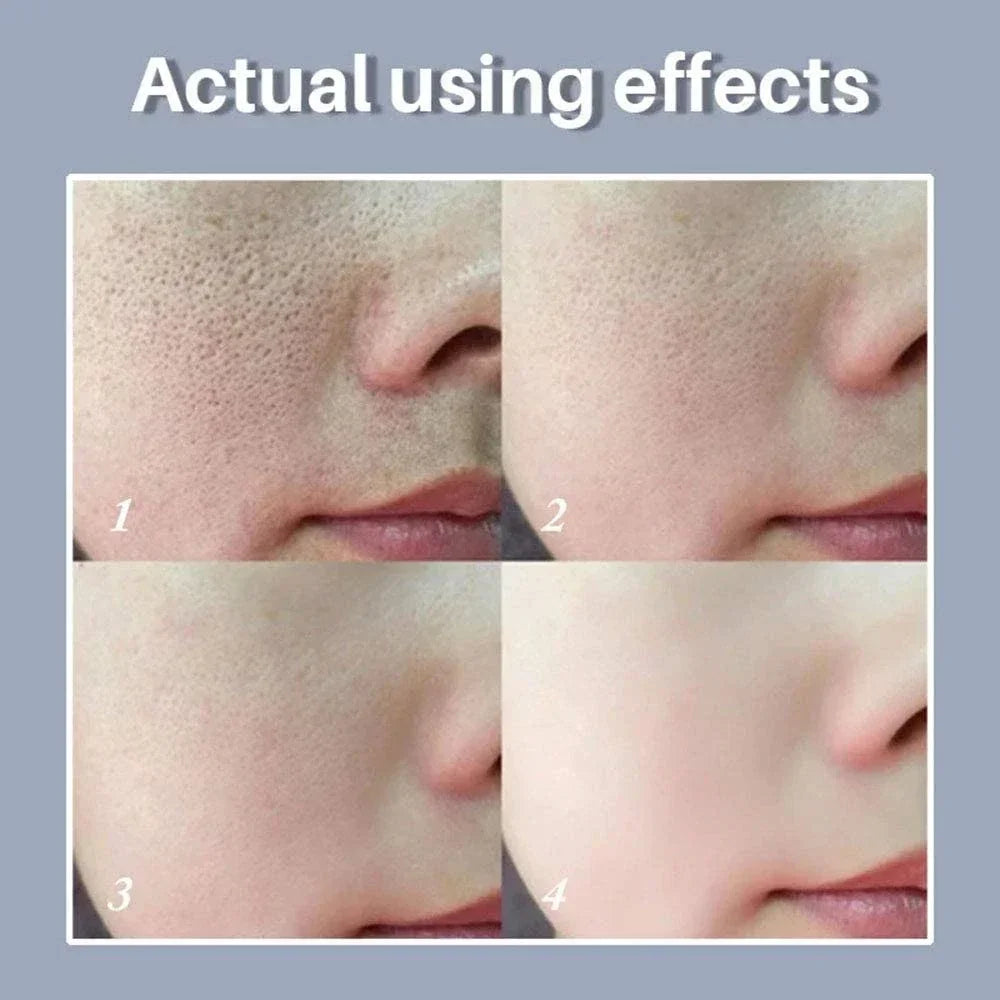 Sérum Éclat & Pores — Rétinol + Niacinamide (10 ml)