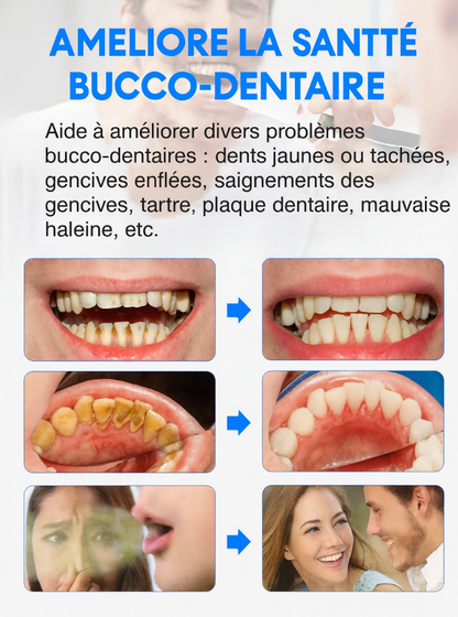 Nettoyage & blanchiment des dents