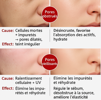 Sérum Éclat & Pores — Rétinol + Niacinamide (10 ml)